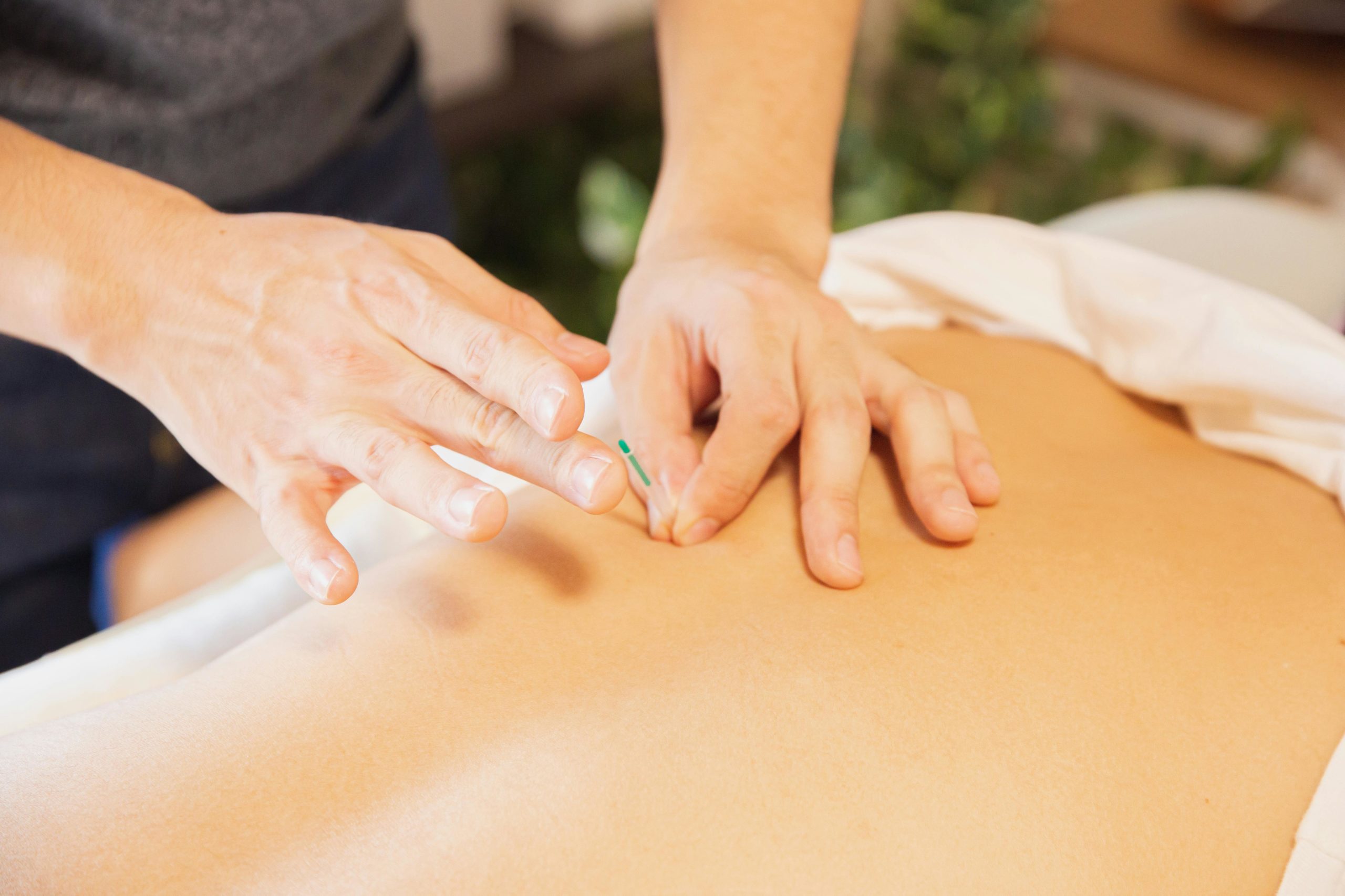 Acupuncture for pain, wellness, healing